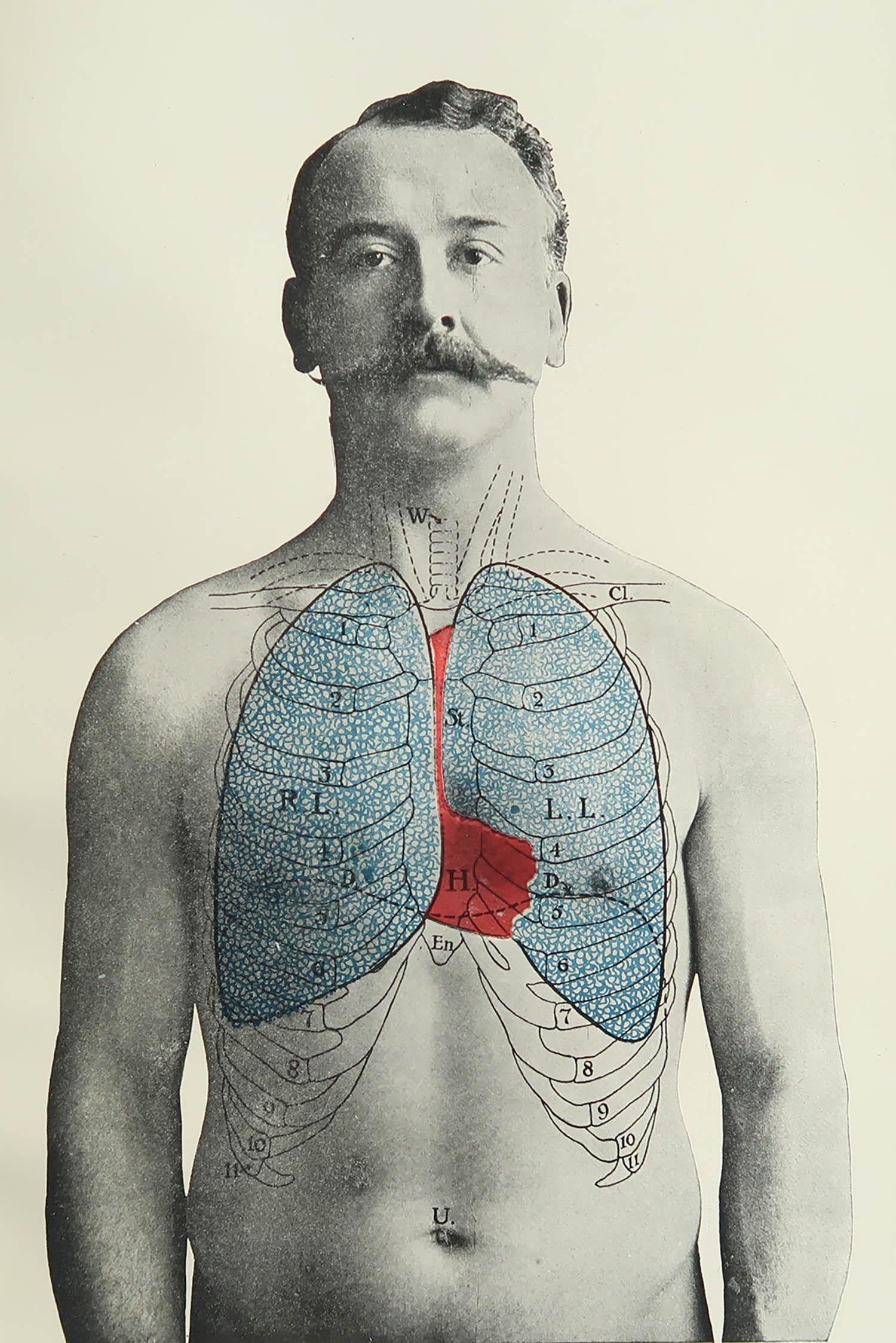 Großartiges Bild von medizinischem Interesse.

Ungerahmt.

Veröffentlicht, um 1900.

Kostenloser Versand





