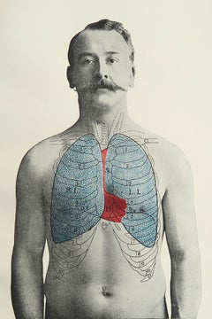 Impresión Médica Vintage Original, Pulmones, C.1900