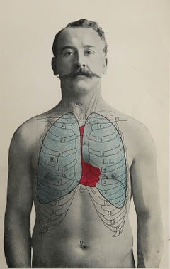 Original Vintage Medical Print, Lungs, C.1900