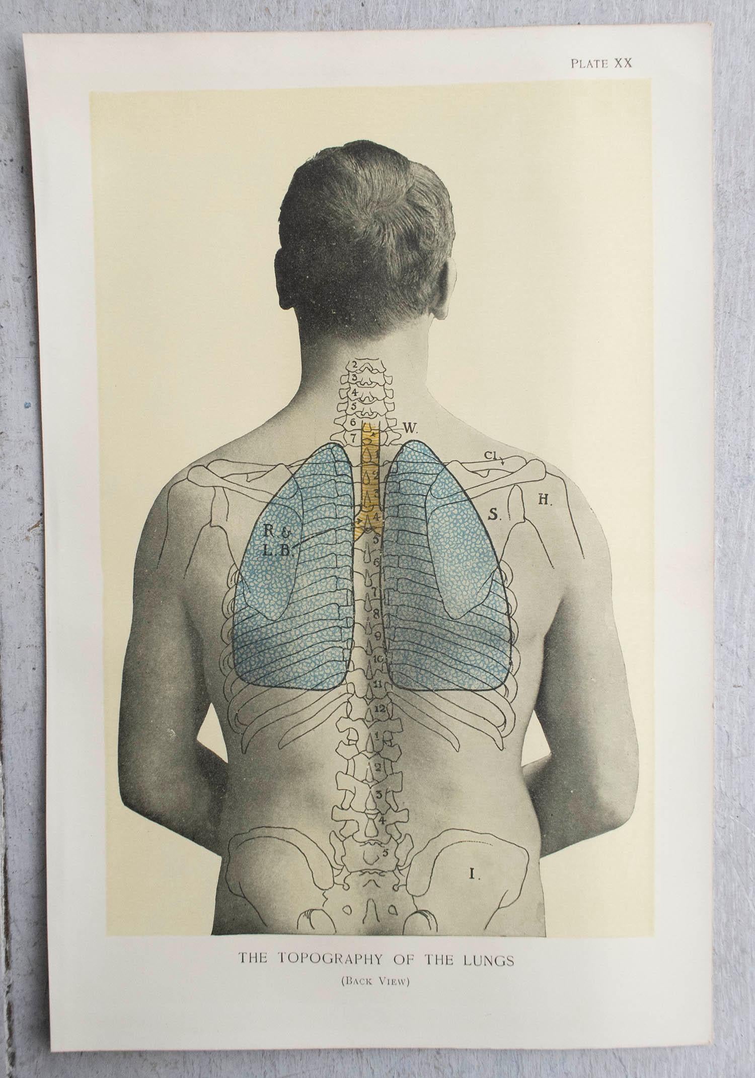 Edwardian Original Vintage Medical Print, Lungs, C.1900 For Sale