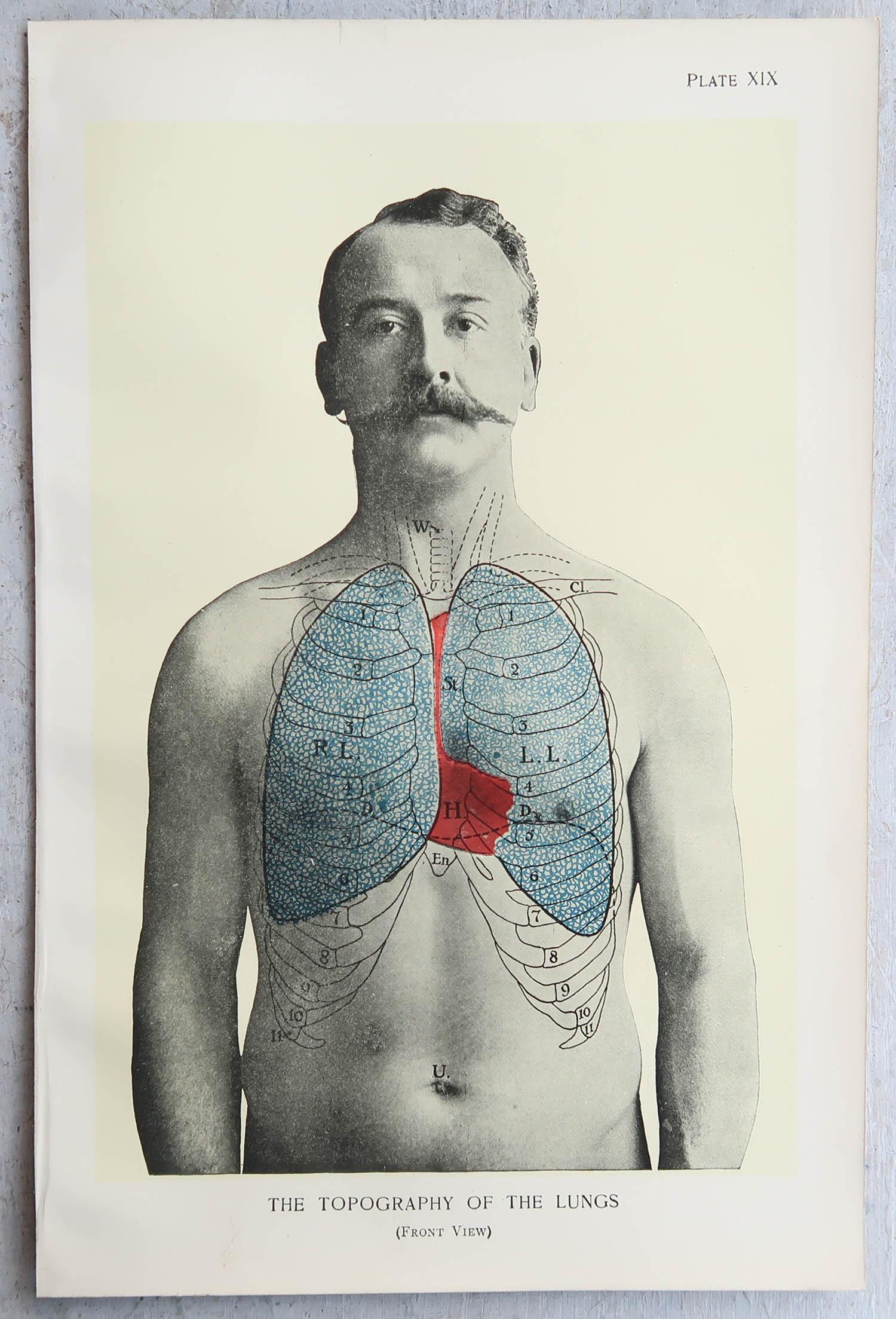 Originaler medizinischer Druck im Vintage-Stil, Lungs, um 1900 (Edwardian) im Angebot