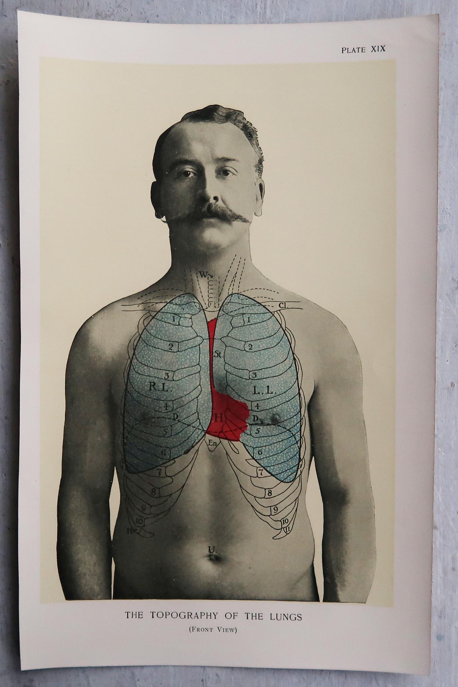 English Original Vintage Medical Print, Lungs, C.1900
