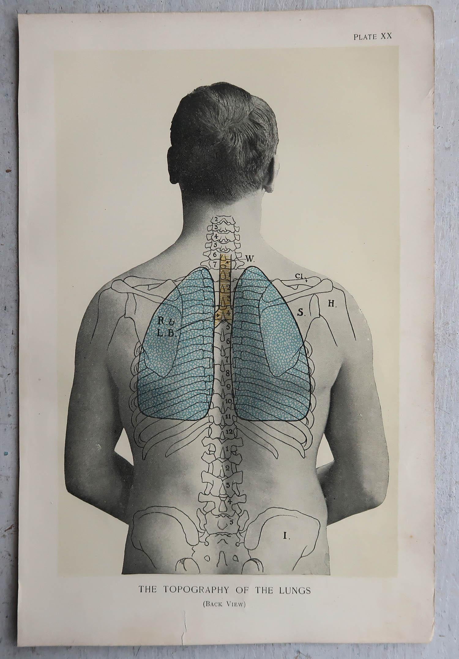 English Original Vintage Medical Print, Lungs, C.1900