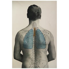 Original Antique Medical Print, Lungs, C.1900