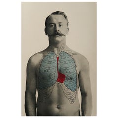 Original Antique Medical Print, Lungs, C.1900