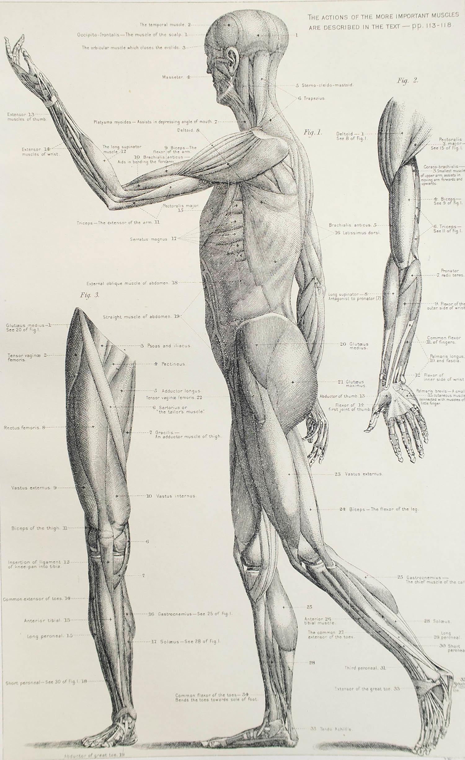Great image of medical interest.

Unframed.

Published, circa 1900.





