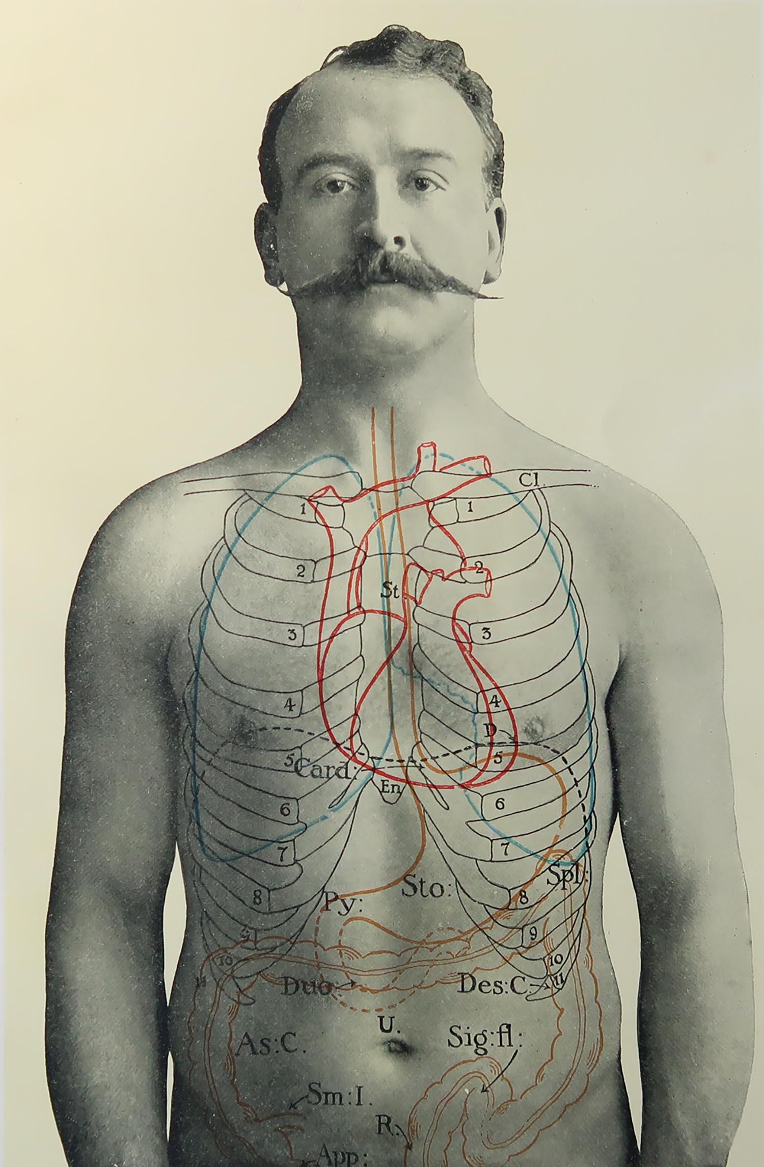 Great image of medical interest

Unframed.

Published, circa 1900.





