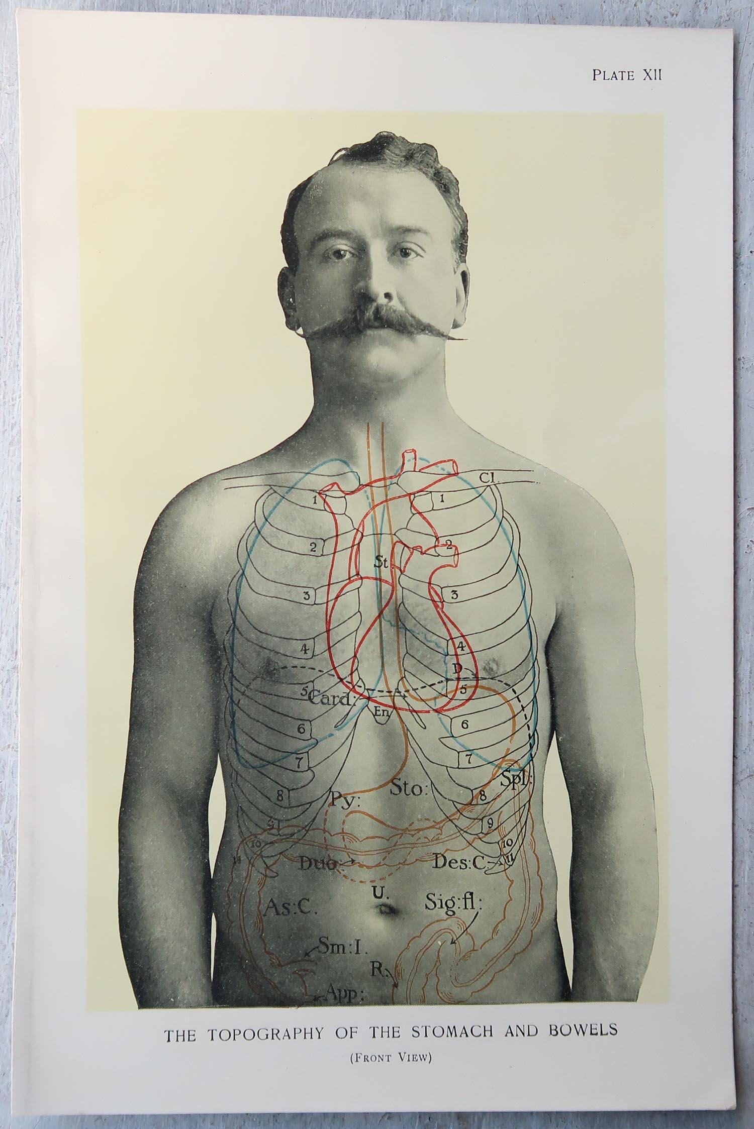 Edwardian Original Vintage Medical Print- Stomach, C.1900