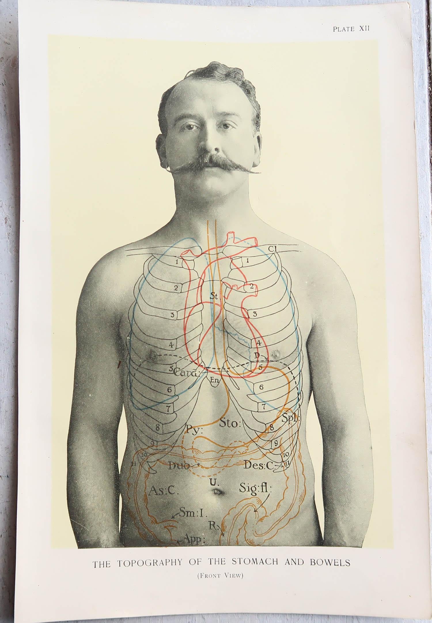 English Original Vintage Medical Print, Stomach, circa 1900