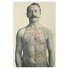Original Antique Medical Print- Stomach, C.1900