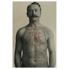 Original Antique Medical Print- Stomach, C.1900