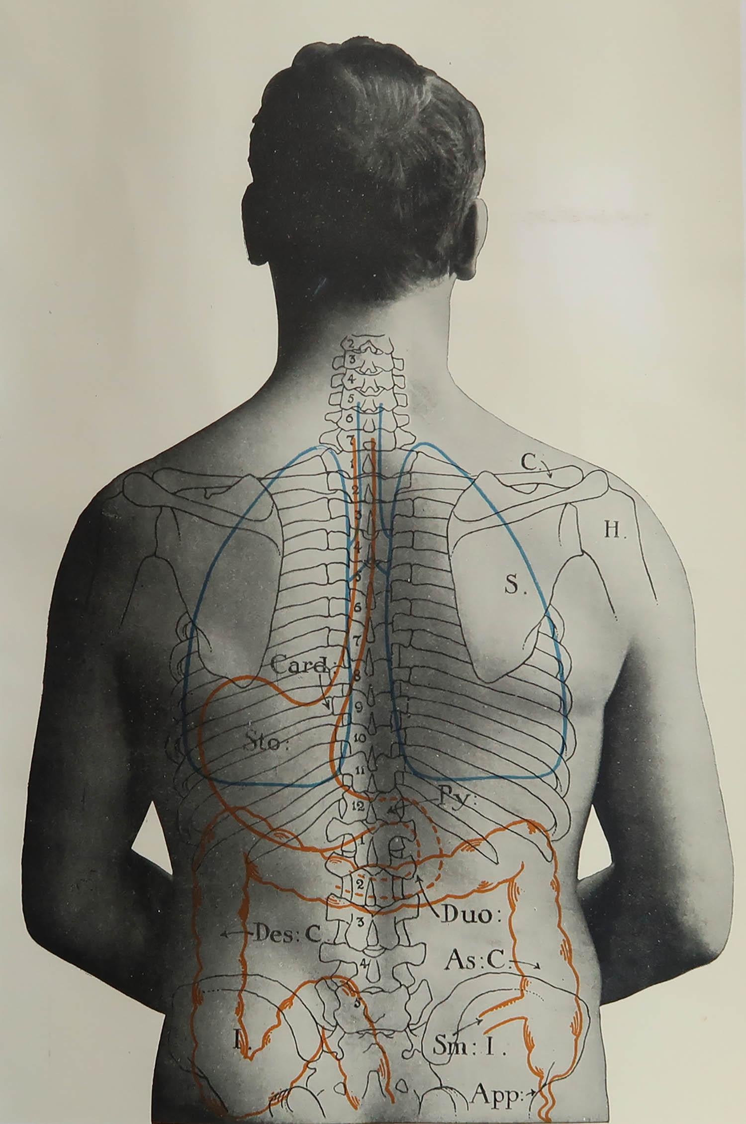 Great image of medical interest

Unframed.

Published, circa 1900.





