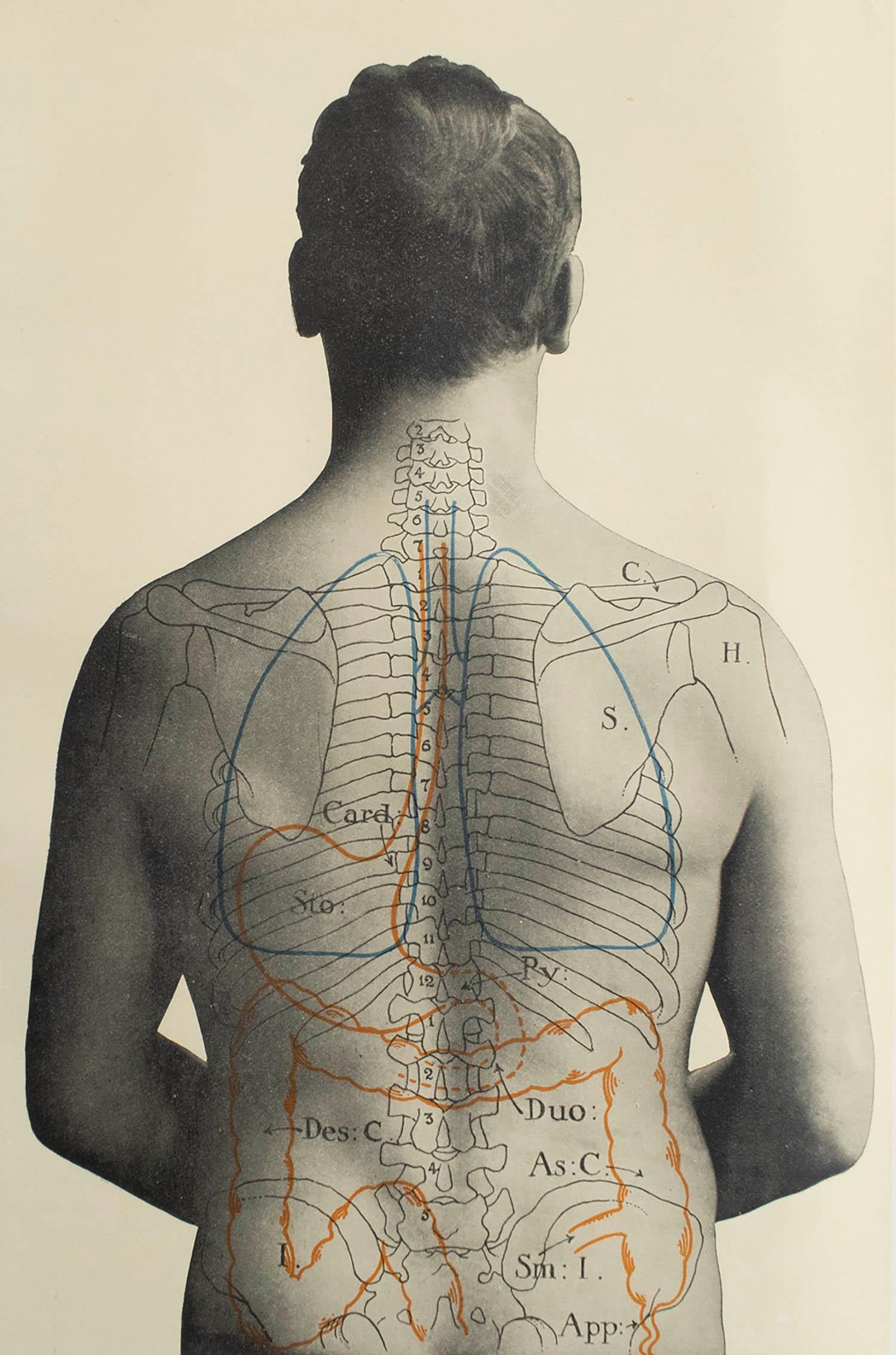 Great image of medical interest

Unframed.

Published, circa 1900.





