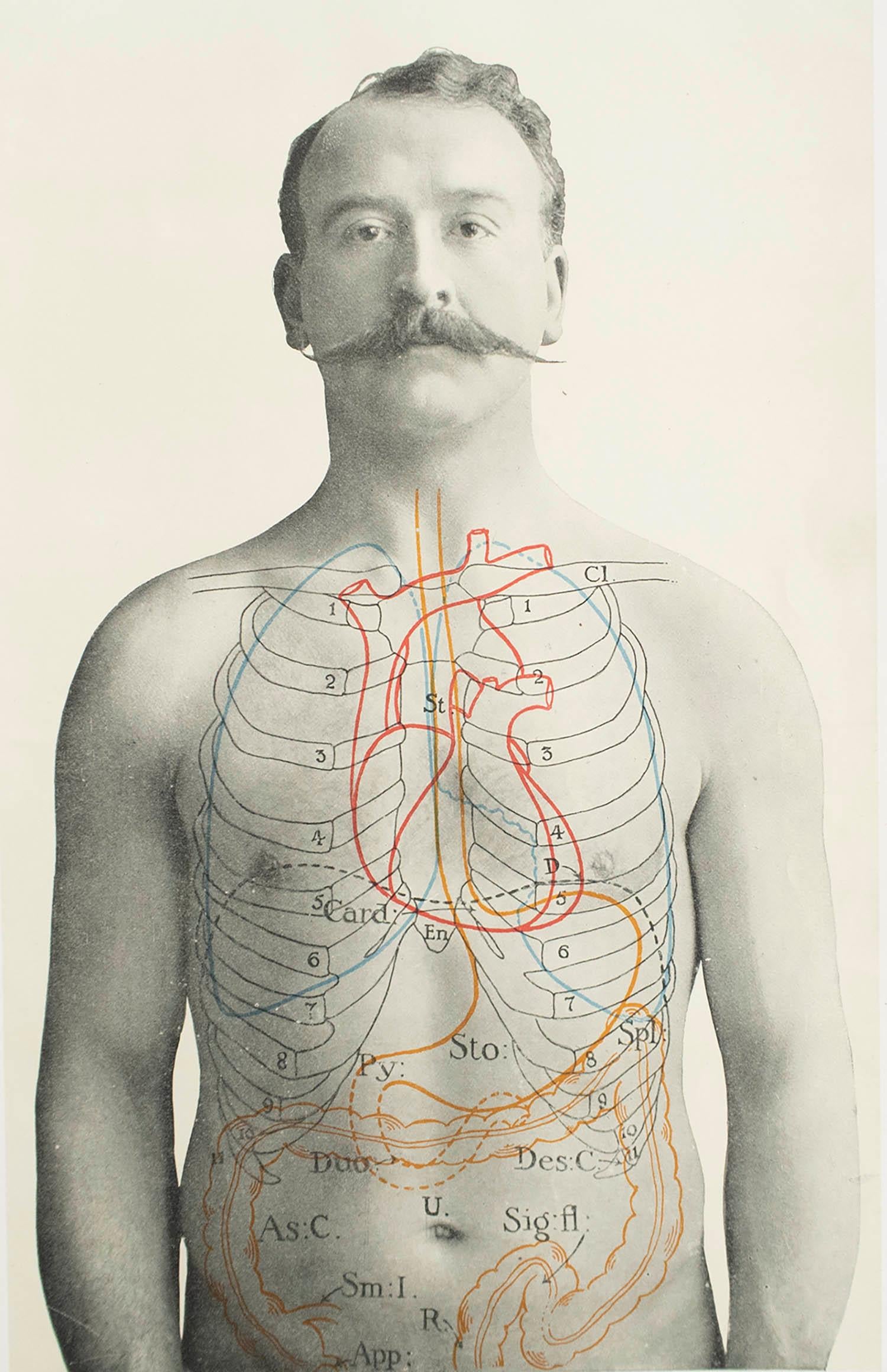 Großartiges Bild von medizinischem Interesse.

Ungerahmt.

Veröffentlicht, um 1900.





