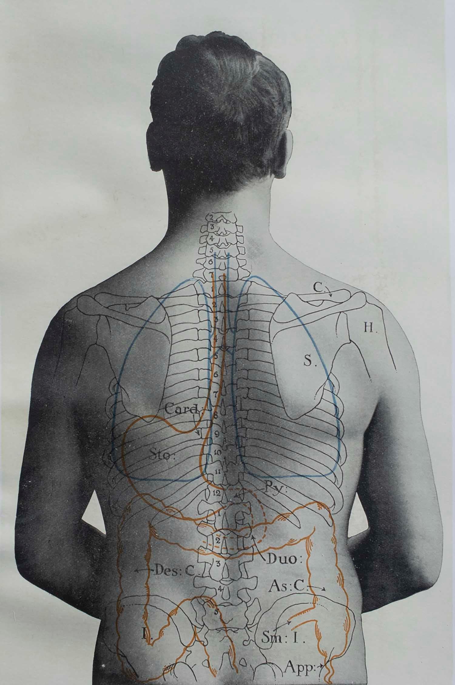 Great image of medical interest

Unframed.

Published, circa 1900.





