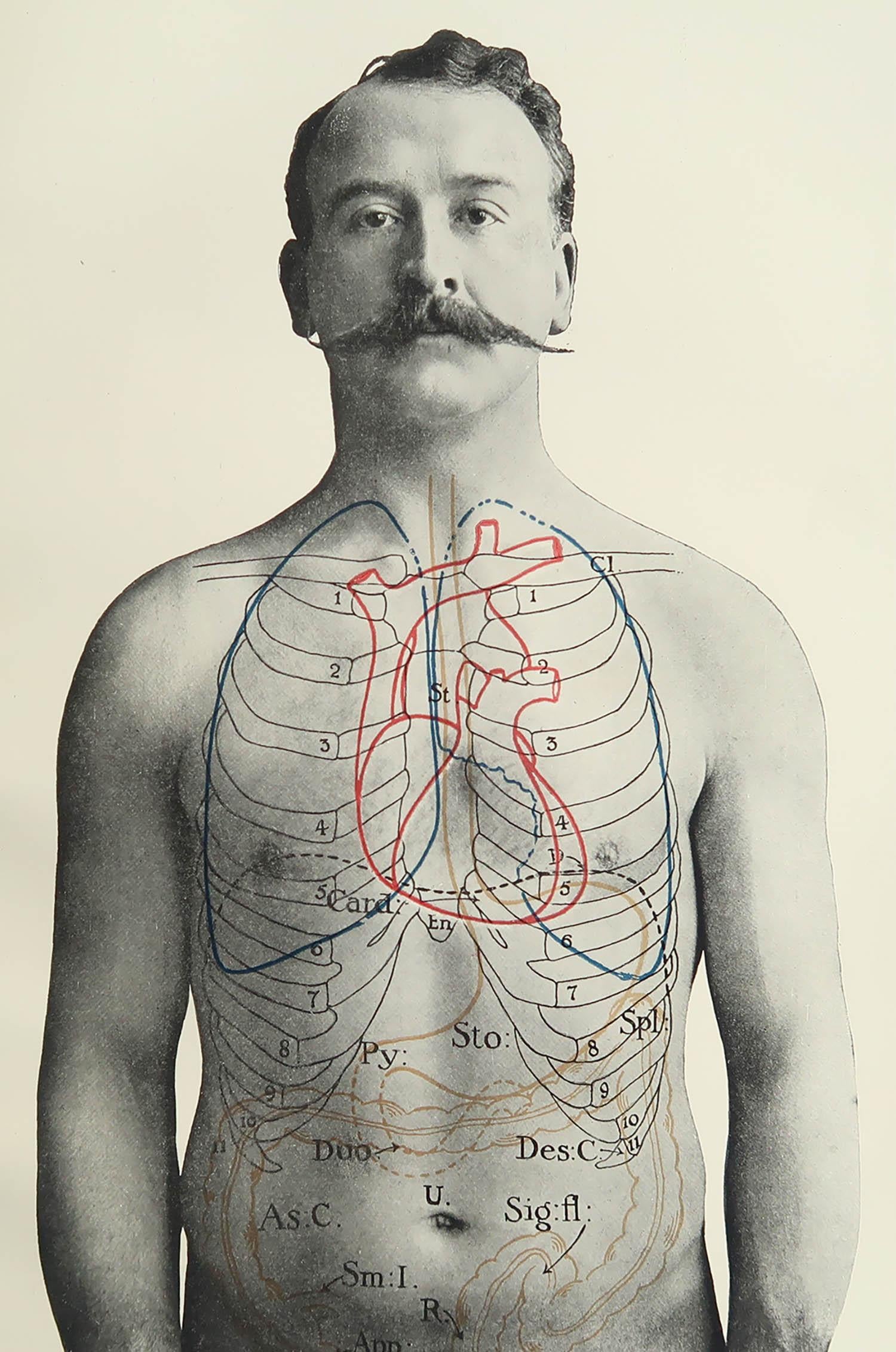 Great image of medical interest.

Unframed.

Published, circa 1900.

Free shipping





