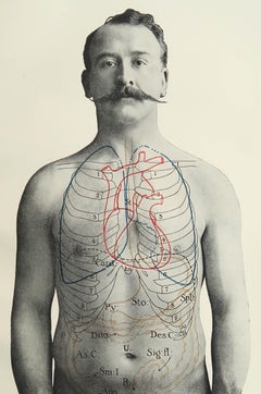 Original Vintage Medical Print, Stomach, circa 1900