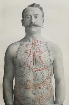 Original Vintage Medical Print, Stomach, circa 1900