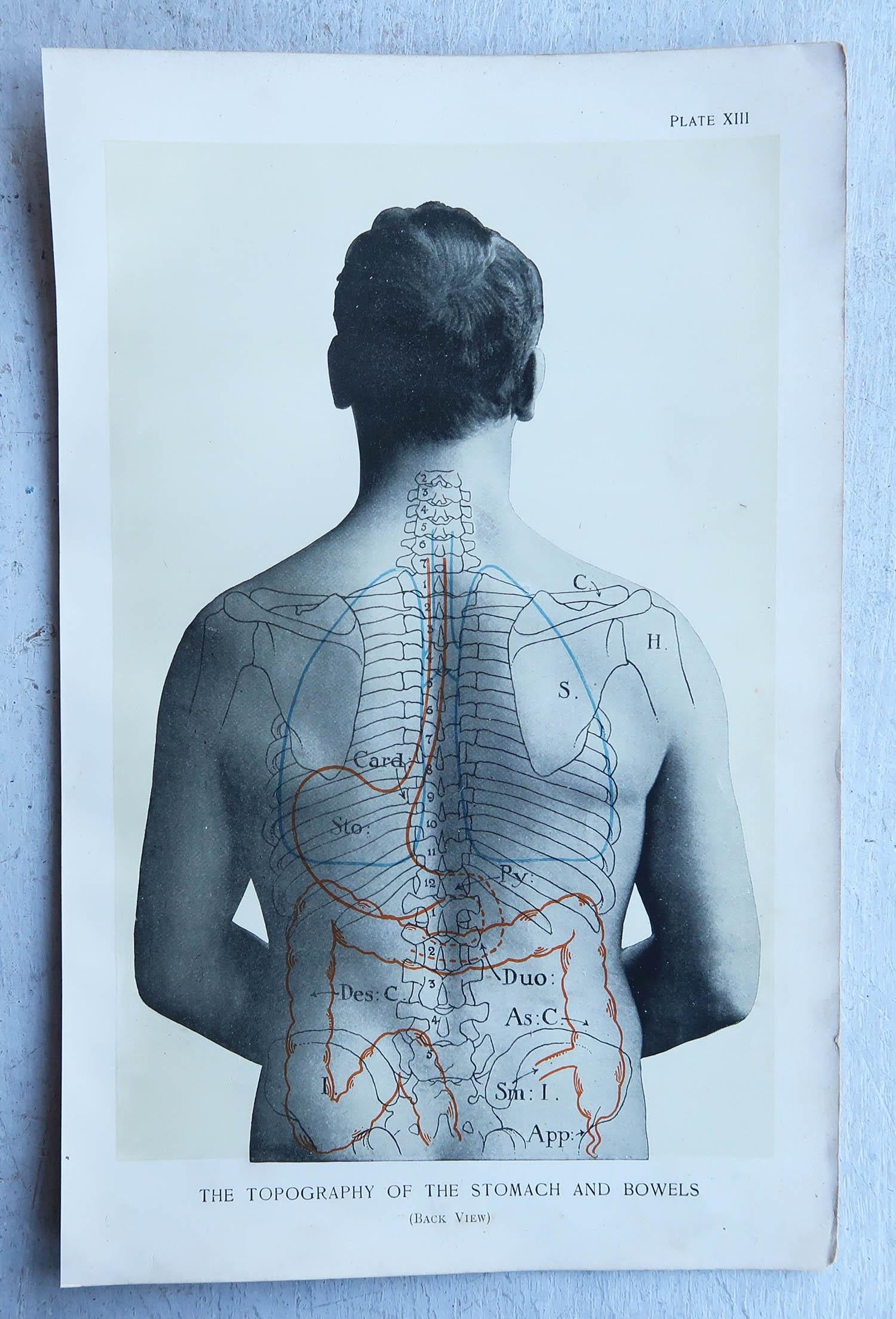 Edwardian Original Vintage Medical Print- Stomach, circa 1900