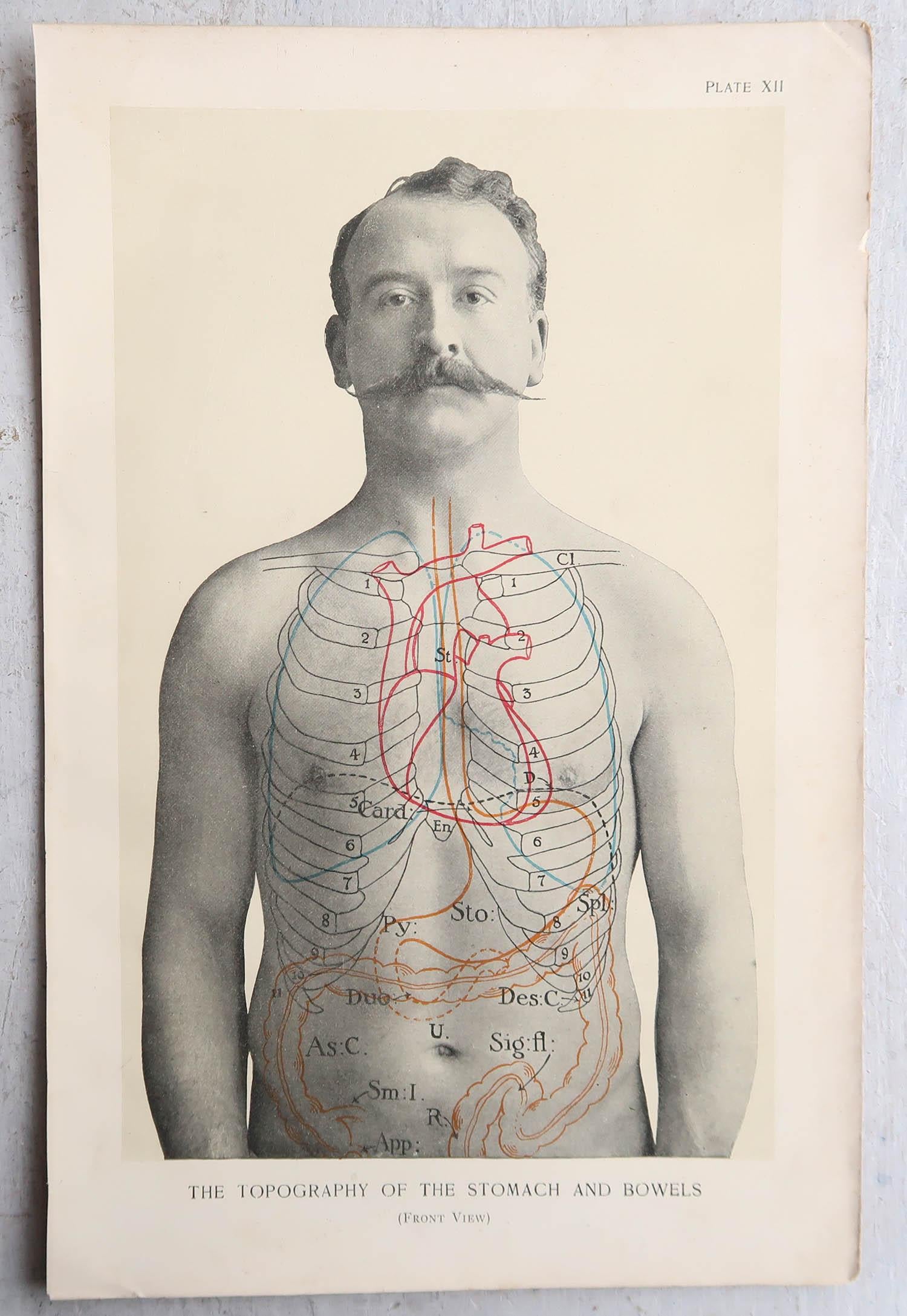 Edwardian Original Vintage Medical Print, Stomach, circa 1900