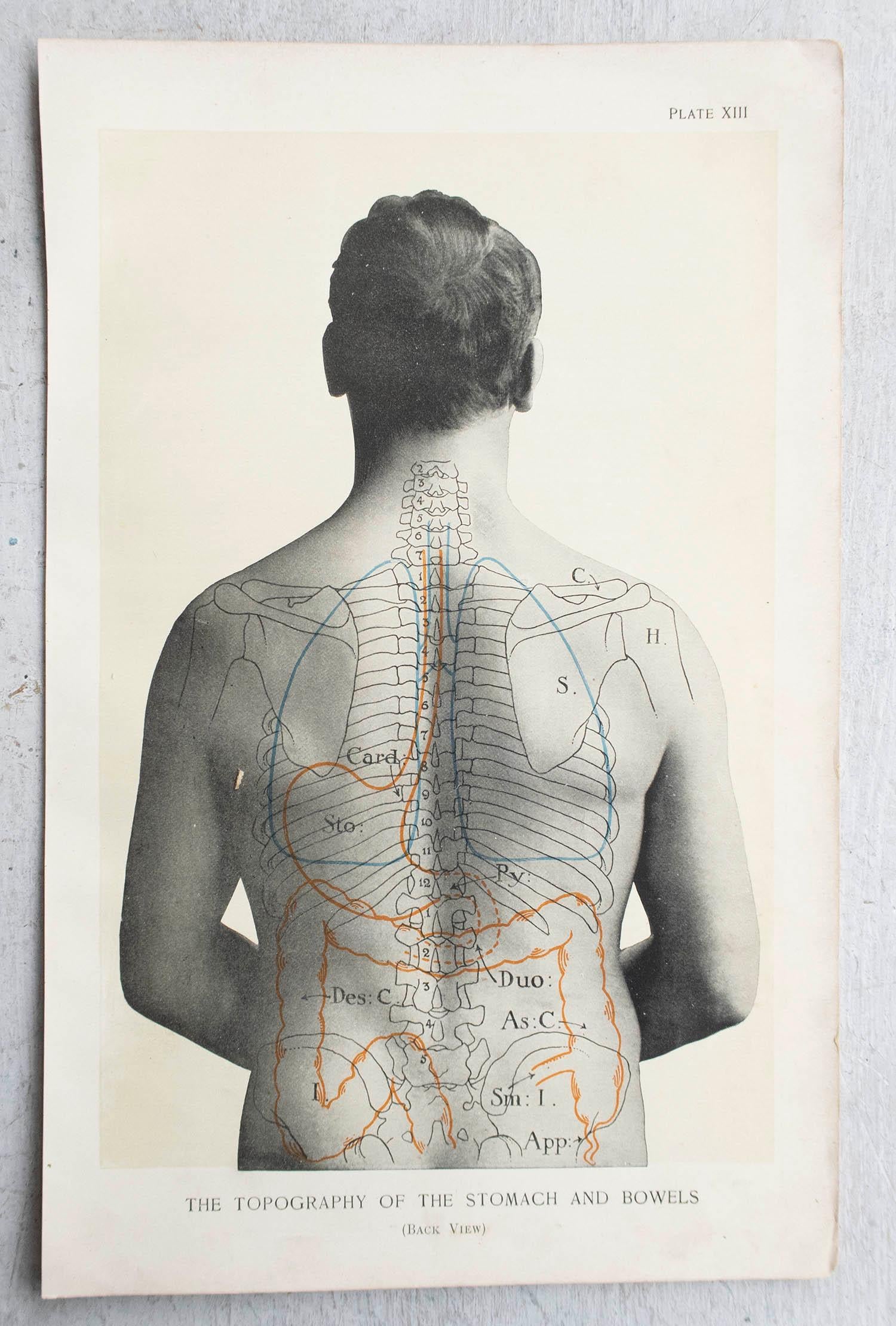 Originaler medizinischer Druck im Vintage-Stil, Stomach, um 1900 (Edwardian) im Angebot