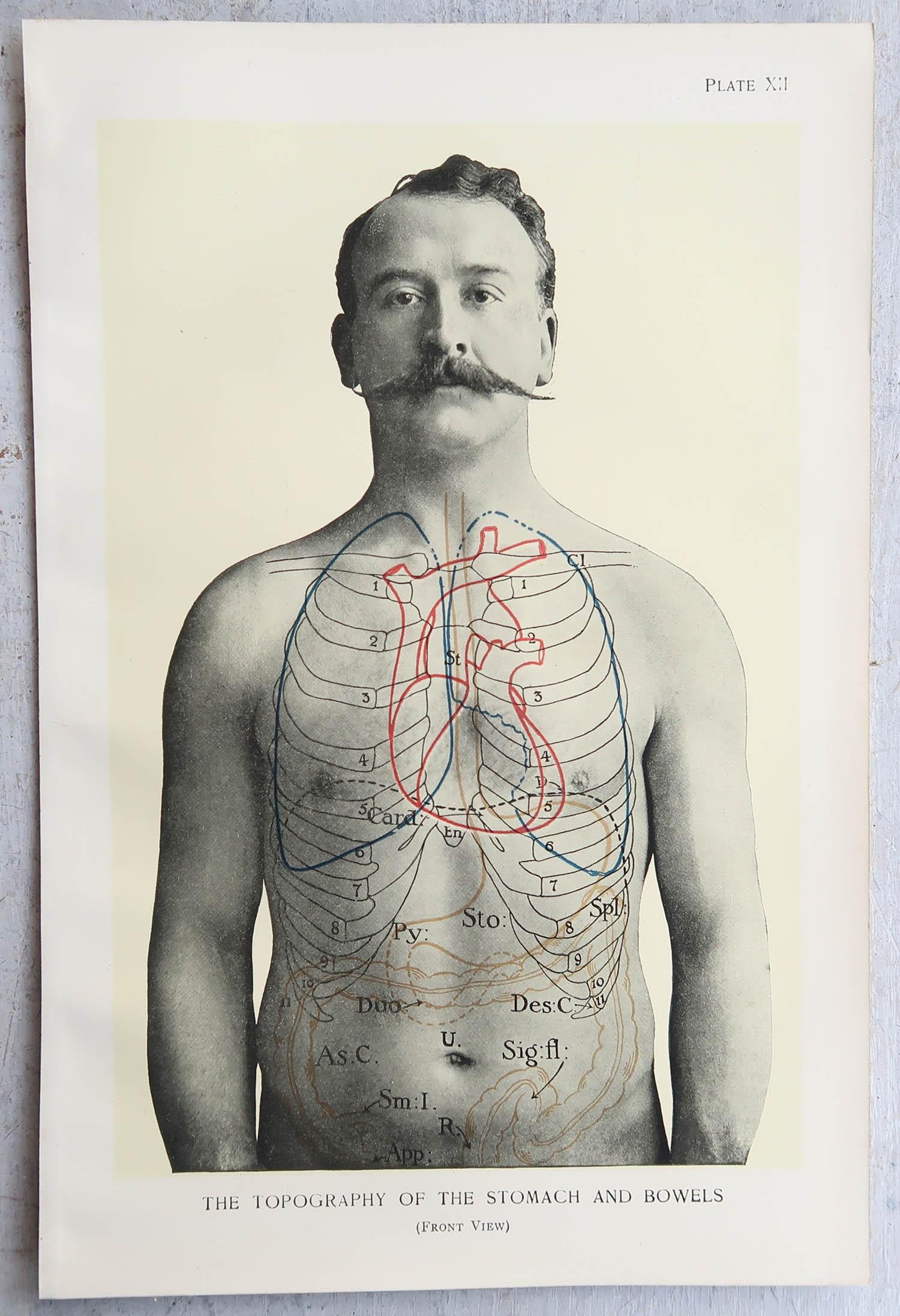 Edwardian Original Vintage Medical Print, Stomach, circa 1900 For Sale