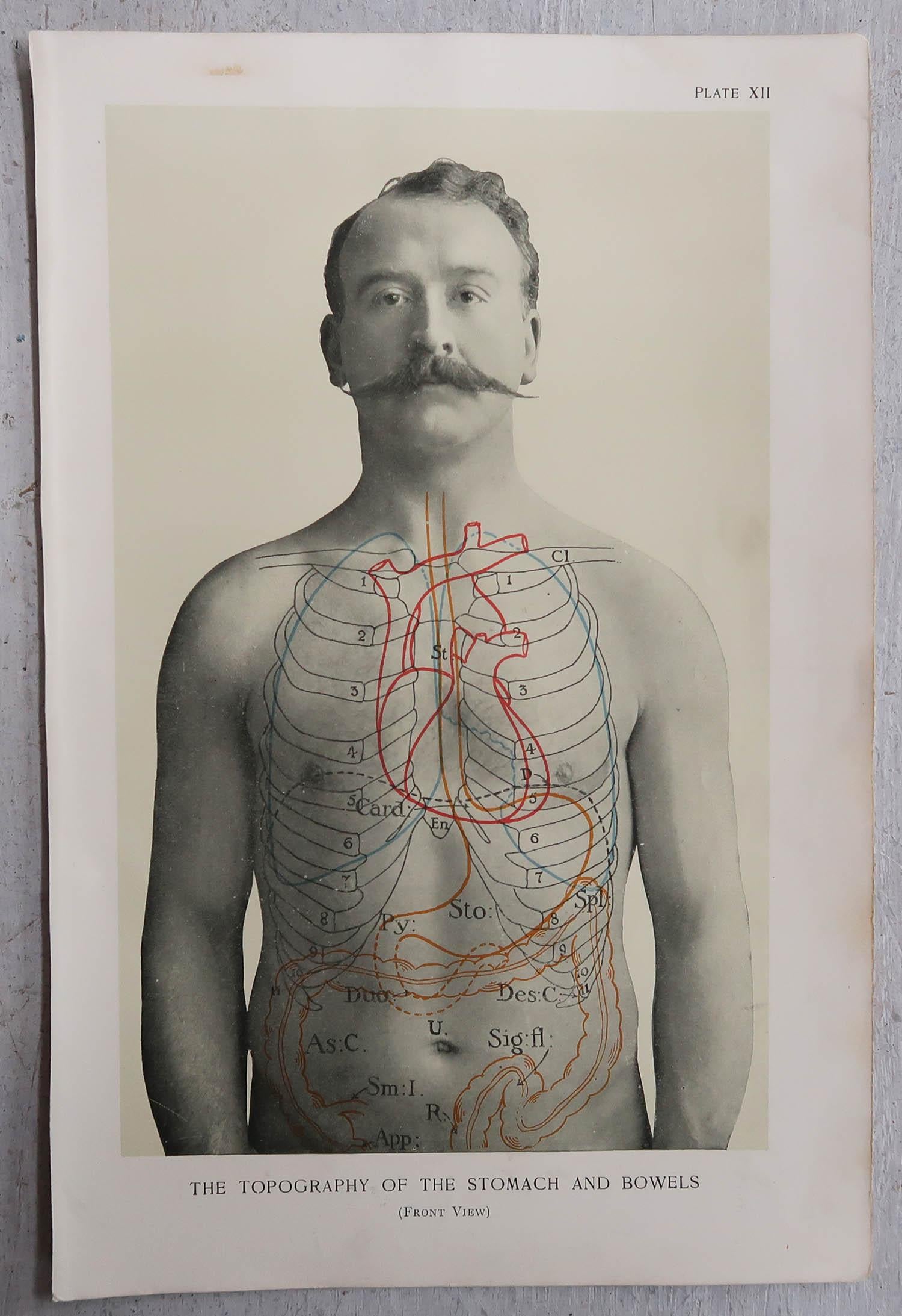 English Original Vintage Medical Print, Stomach, circa 1900