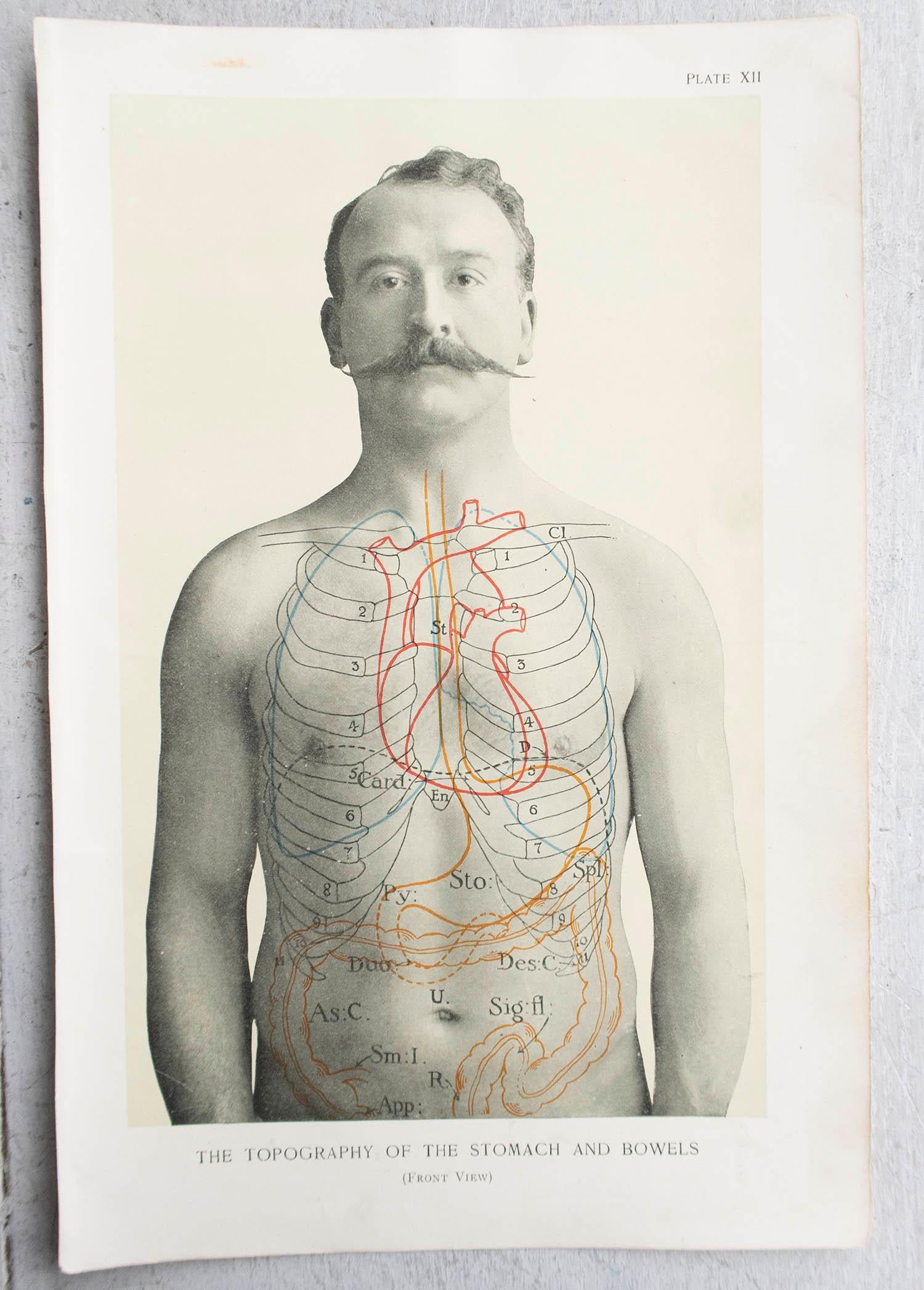 English Original Vintage Medical Print, Stomach, circa 1900 For Sale