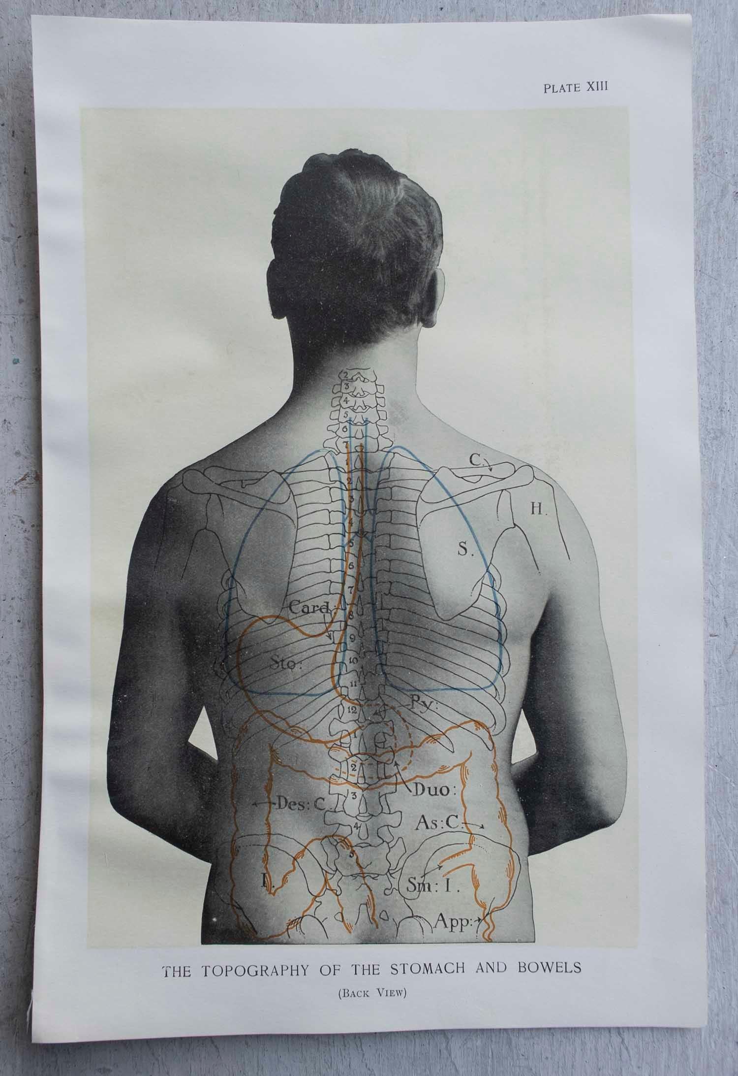 English Original Vintage Medical Print- Stomach, circa 1900 For Sale