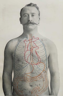 Original Vintage Medical Print, Stomach, circa 1900