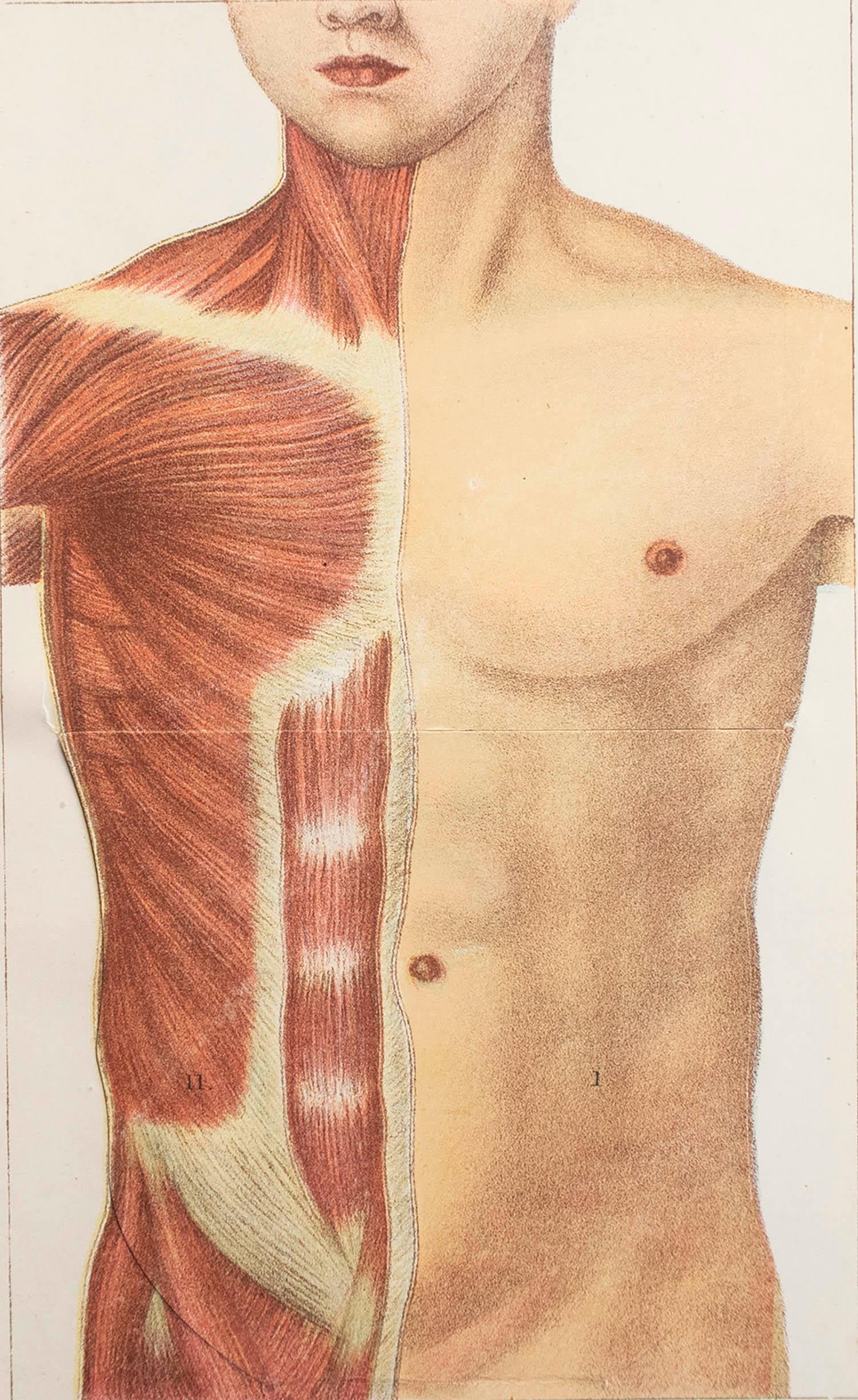 Grande image d'intérêt médical.

Non encadré.

Publié, vers 1900.





