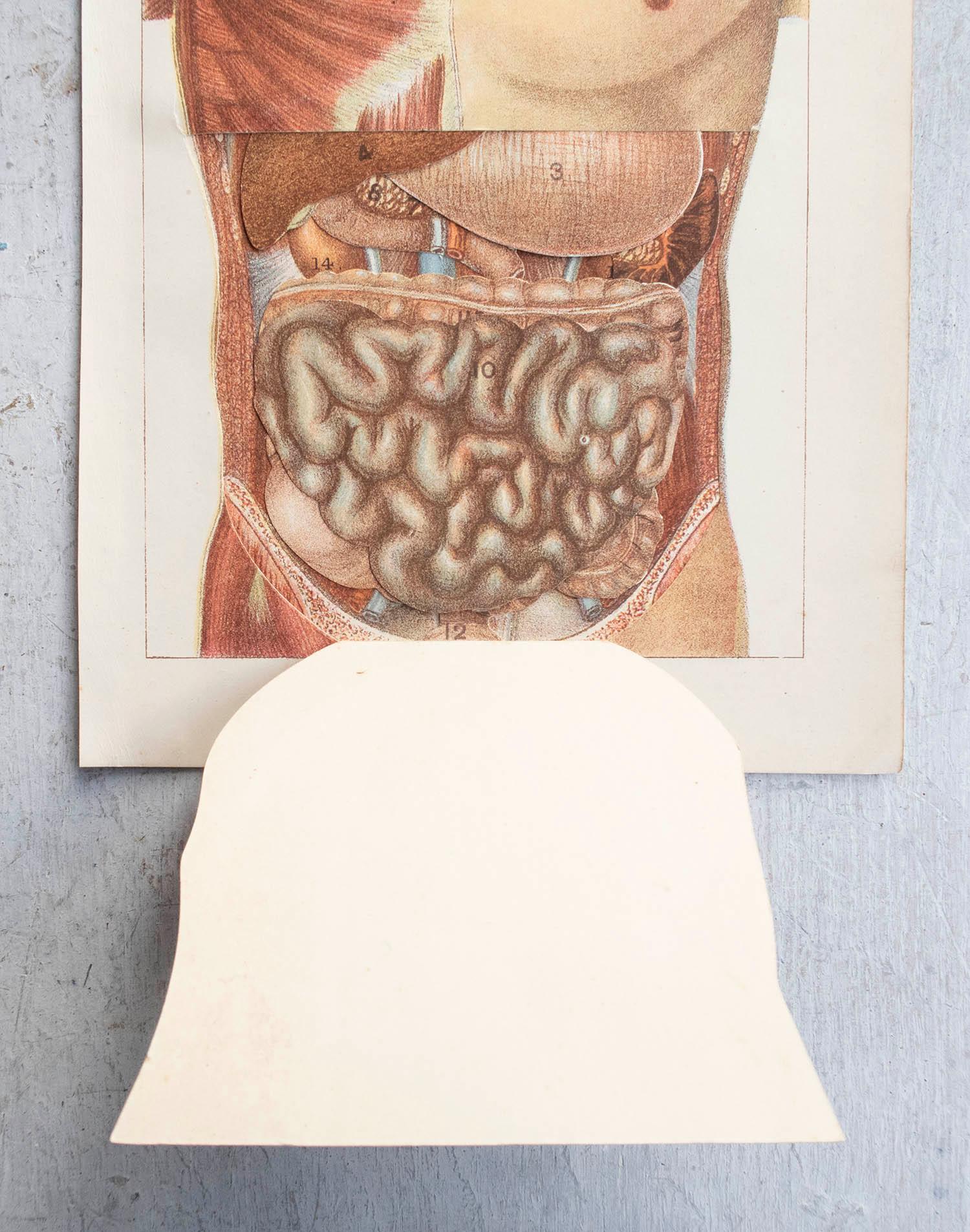 Anglais Impression médicale originale de l'Abdomen, vers 1900 en vente