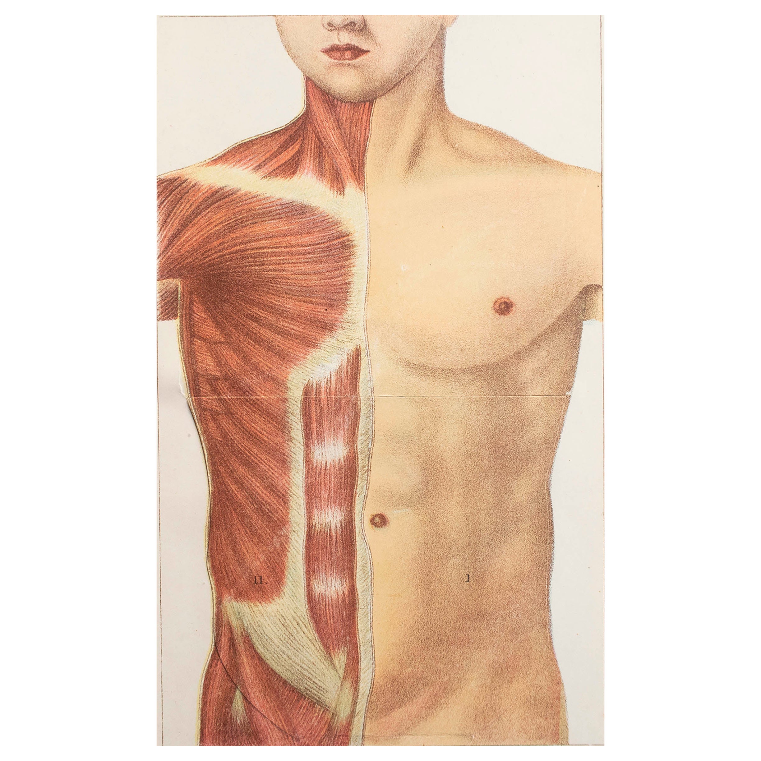 Original Vintage Medical Print- The Abdomen, C.1900