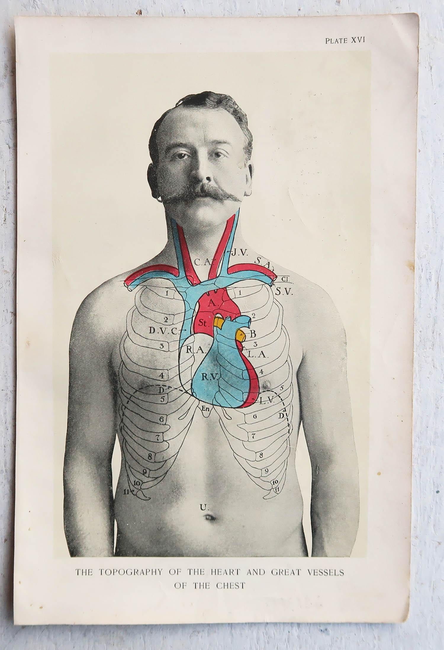 Edwardian Original Vintage Medical Print, the Heart, circa 1900