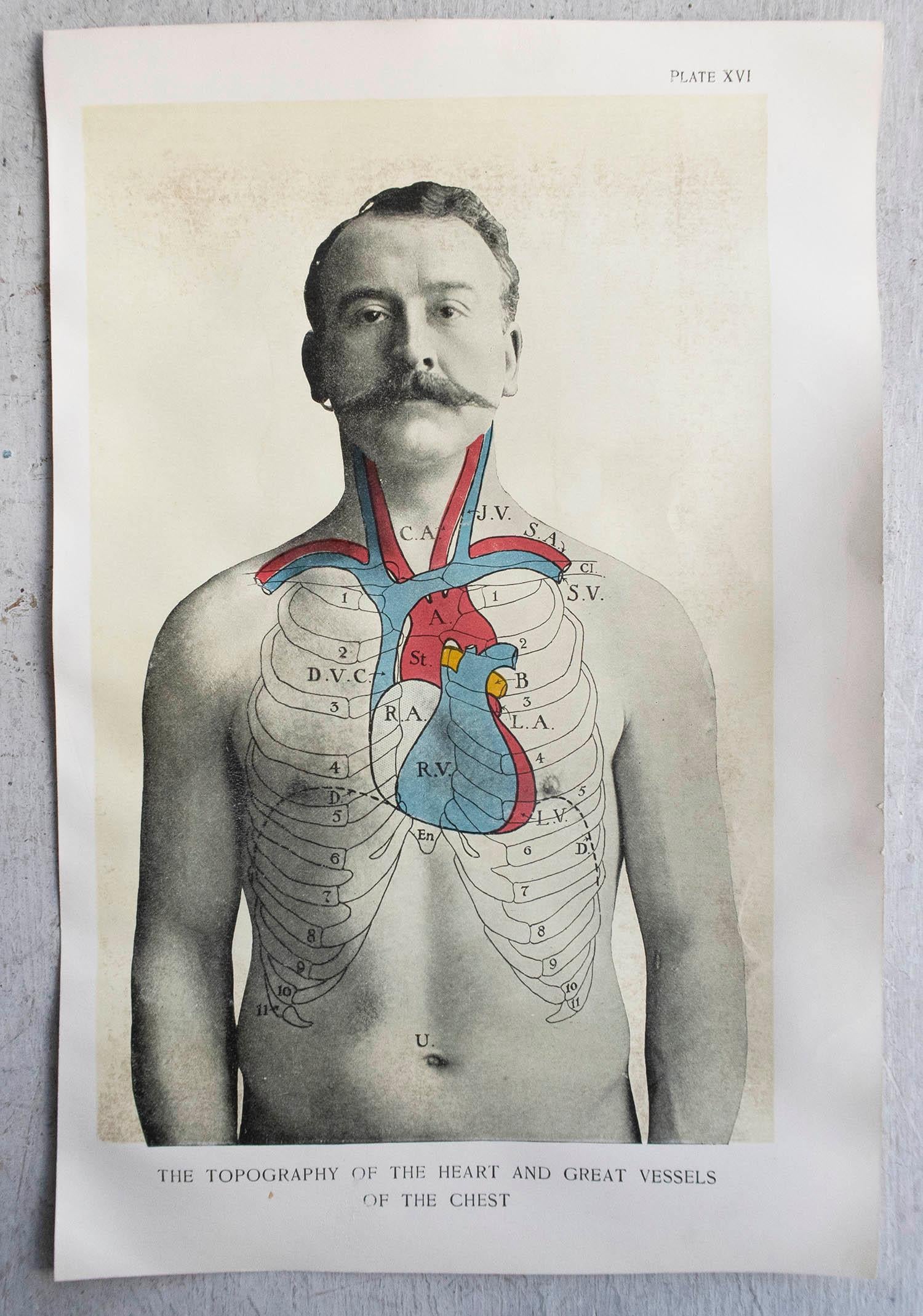 English Original Vintage Medical Print, the Heart, circa 1900 For Sale