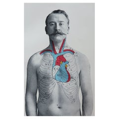 Original Antique Medical Print, the Heart, circa 1900