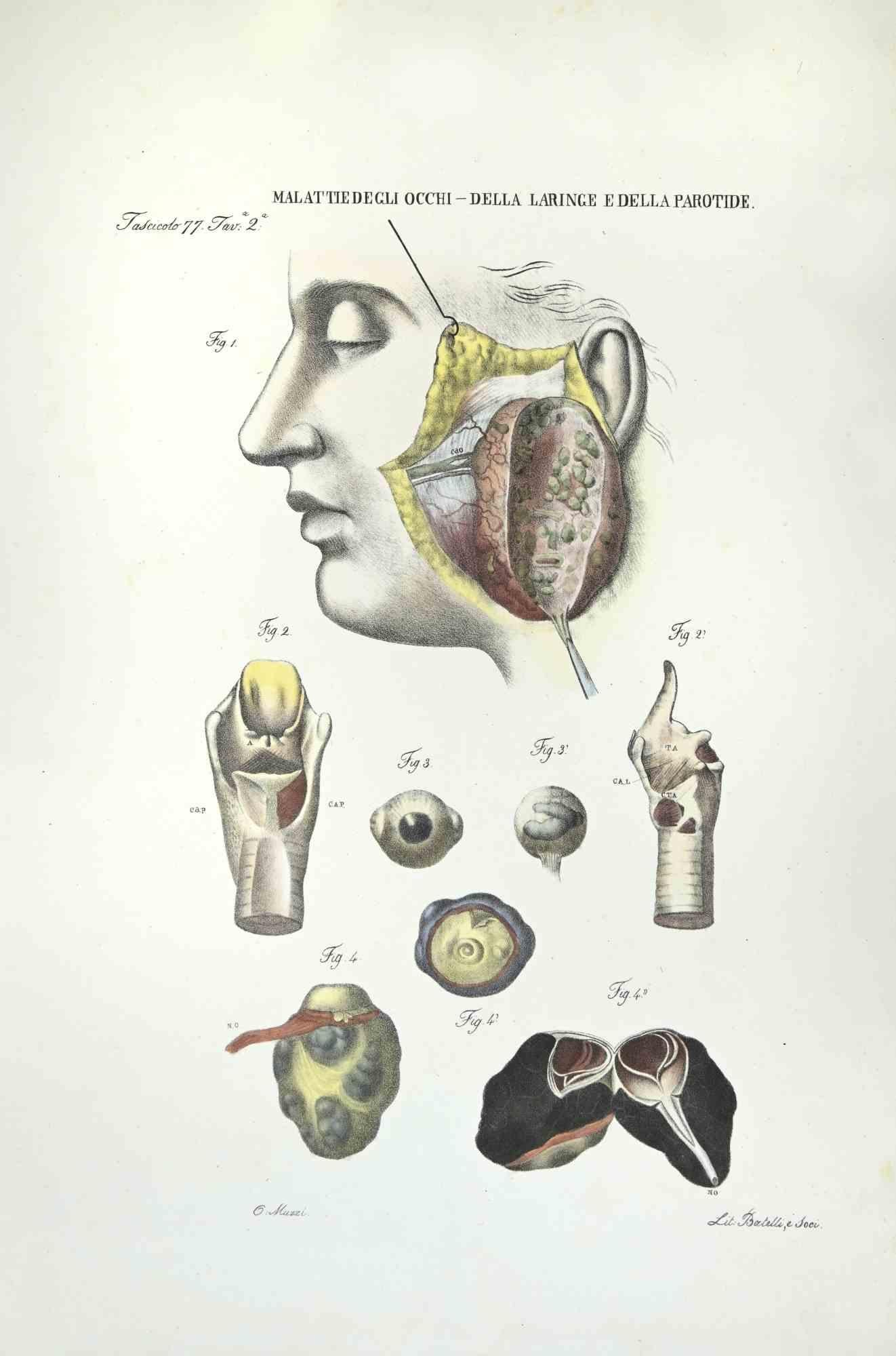 Diseases of the Eyes - Larynx and Parotis is a lithograph hand colored by Ottavio Muzzi for the edition of Antoine Chazal,Human Anatomy, Printers Batelli and Ridolfi, realized in 1843.

Signed on plate on the lower left margin.

The artwork belongs