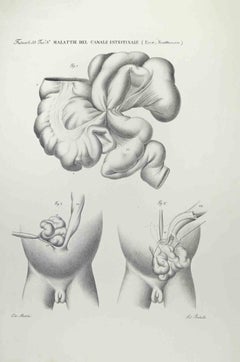 Antique Diseases of the Intestines  - Lithograph By Ottavio Muzzi - 1843
