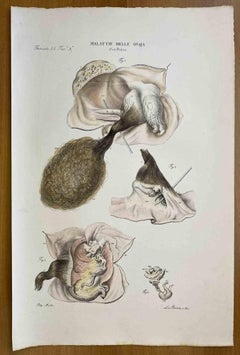 diseases of the Ovary – Lithographie von Ottavio Muzzi – 1843