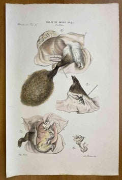 Diseases of the Ovary - Lithograph By Ottavio Muzzi - 1843