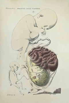 Krankheiten des Pflanzgefäßes – Lithographie von Ottavio Muzzi – 1843