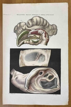 Antique Diseases of the Stomach and Intestines - Lithograph By Ottavio Muzzi - 1843