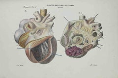Antique Heart Diseases - Lithograph By Ottavio Muzzi - 1843