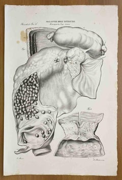 Intestinal Diseases - Lithograph By Ottavio Muzzi - 1843