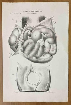 Antique Intestinal Diseases - Lithograph By Ottavio Muzzi - 1843