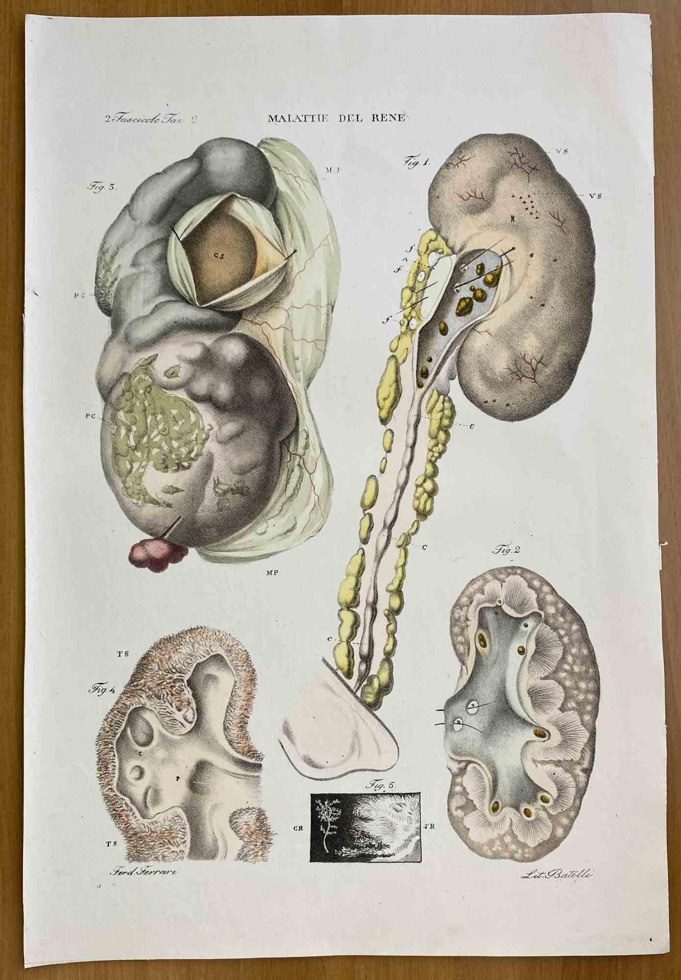 Knöchelkrankheiten – Lithographie von Ottavio Muzzi – 1843