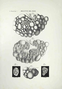 Kidney Diseases - Lithograph By Ottavio Muzzi - 1843