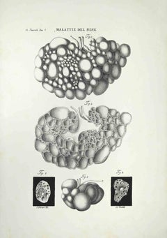 Antique Kidney Diseases - Lithograph By Ottavio Muzzi - 1843