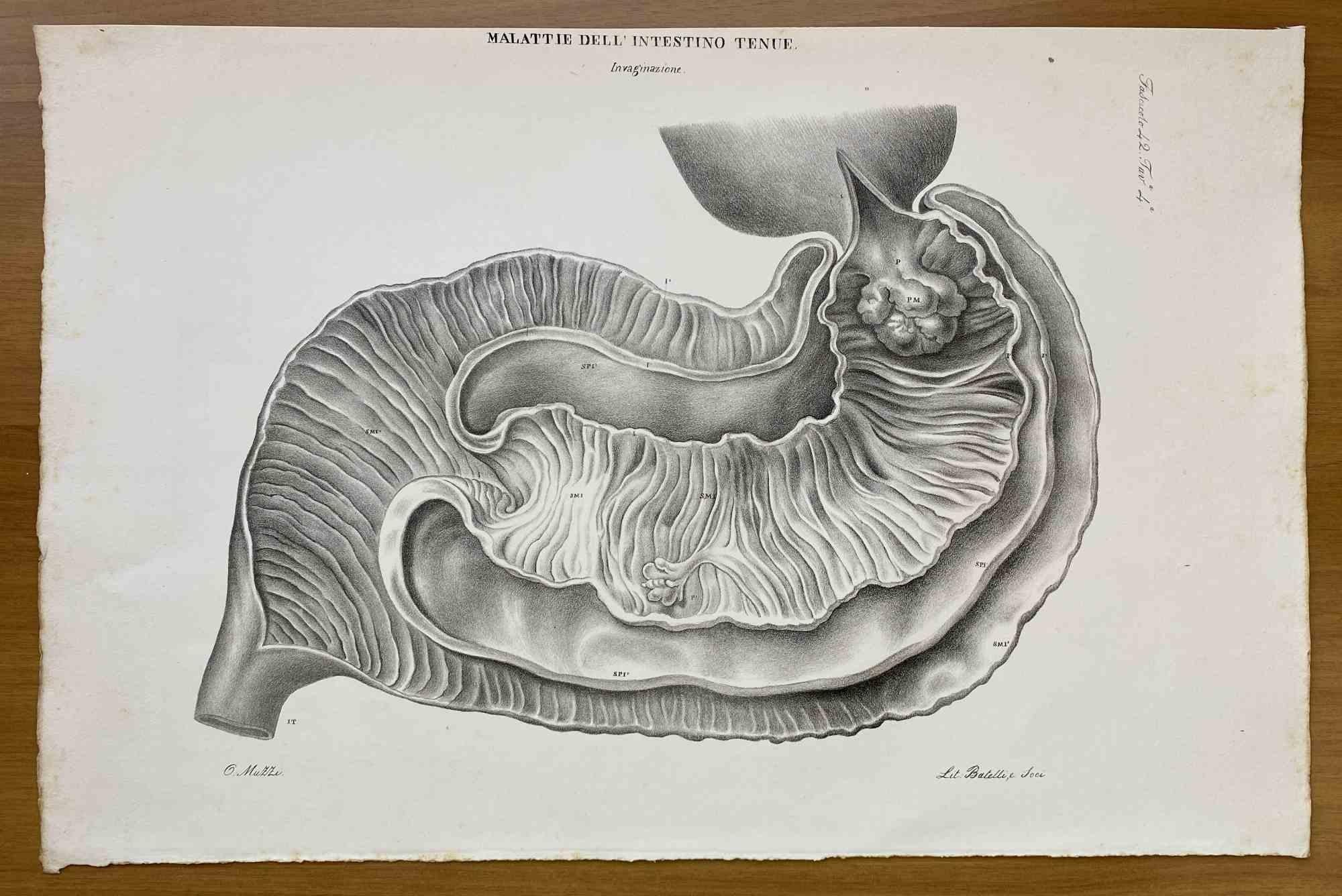 Small Intestine Disease ist eine handkolorierte Lithographie von Ottavio Muzzi für die Ausgabe von Antoine Chazal, Human Anatomy, Printers Batelli and Ridolfi, 1843.

Das Werk gehört zum Atlante generale della anatomia patologica del corpo umano von