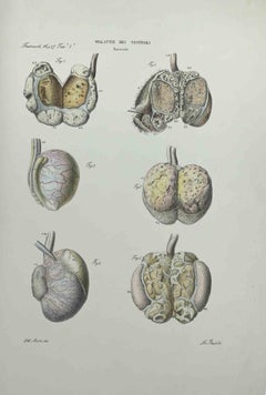 Antique Testicles Diseases - Lithograph By Ottavio Muzzi - 1843